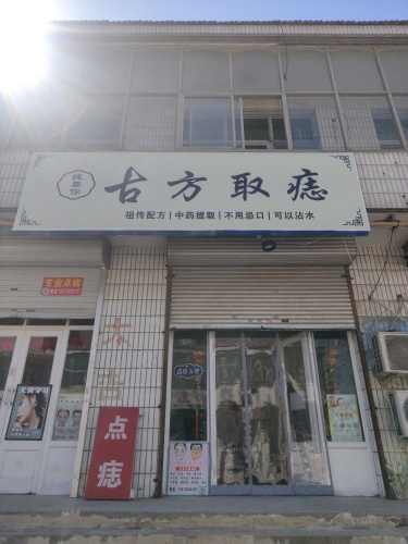 古方取痣【痣要你】